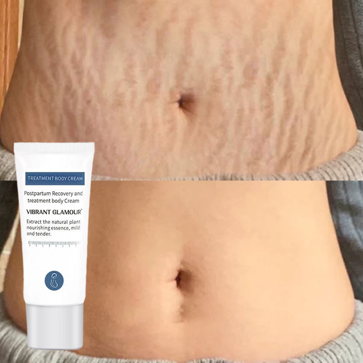 Vibrant Glamour Kem Làm Mờ Vết Rạn Da Sau Sinh 30g,kem dưỡng trắng phục hồi da, cải thiện vết rạn da, tinh chất dưỡng ẩm làm săn chắc da, cải thiện vết rạn sau sinh