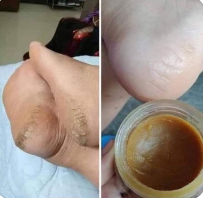 Cao lá đông y chính hãng