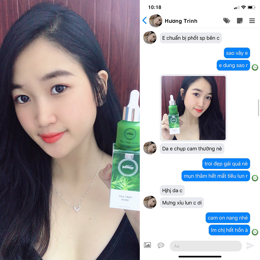 Serum trị mụn Tràm Trà Venus 15ml