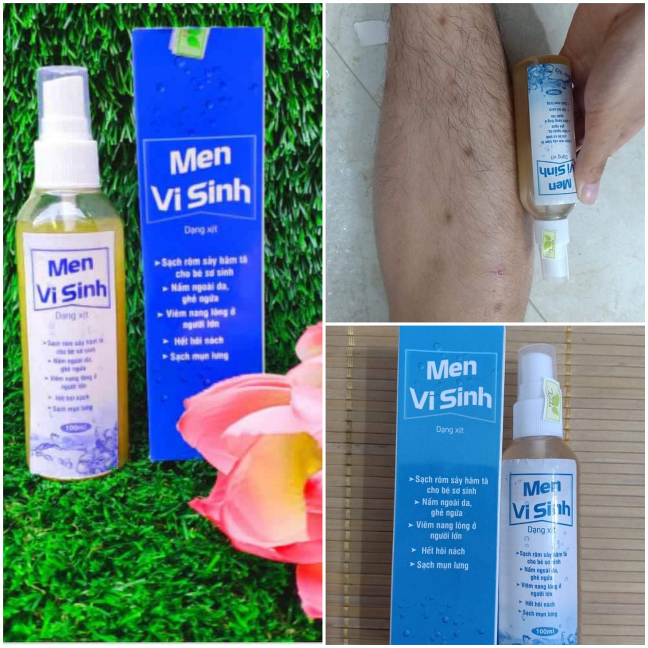 COMBO 3 CHAI MEN VI SINH TAVIDA LÀM SẠCH VIÊM DA, MỤN, NẤM NGỨA combo phù hợp cho những ai mụn nặng giá ưu đãi và đỡ phí ship