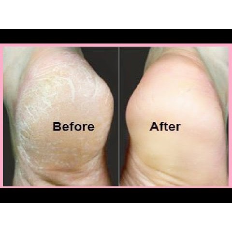 ĐÁ BỌT CHÀ GÓT CHÂN KÈM BÀN CHẢI CHÀ MÓNG