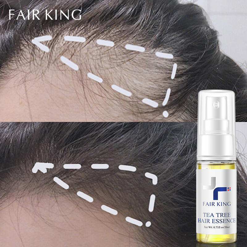 FAIR KING TINH CHẤT TÓC TRÀM TRÀ NGĂN NGỪA rụng tóc Tinh dầu thảo dược TEA TREE HAIR ESSENCE 20ml - intl
