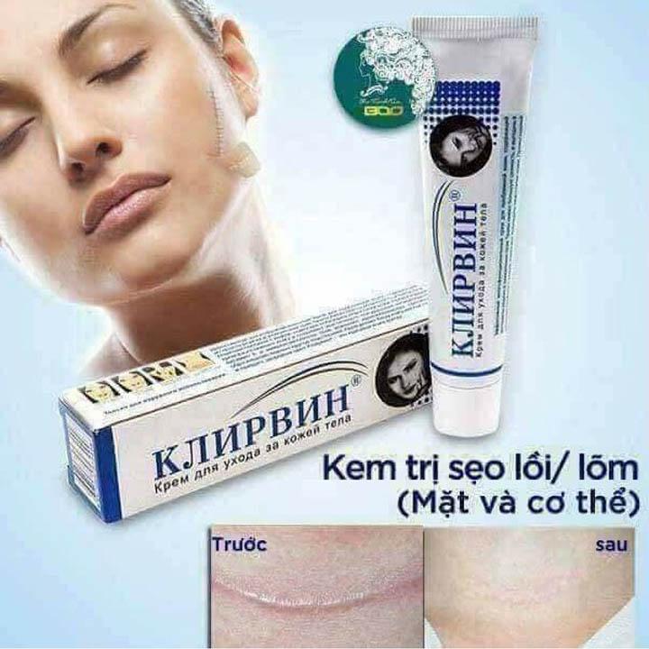 Kem trị seo cao cấp nga