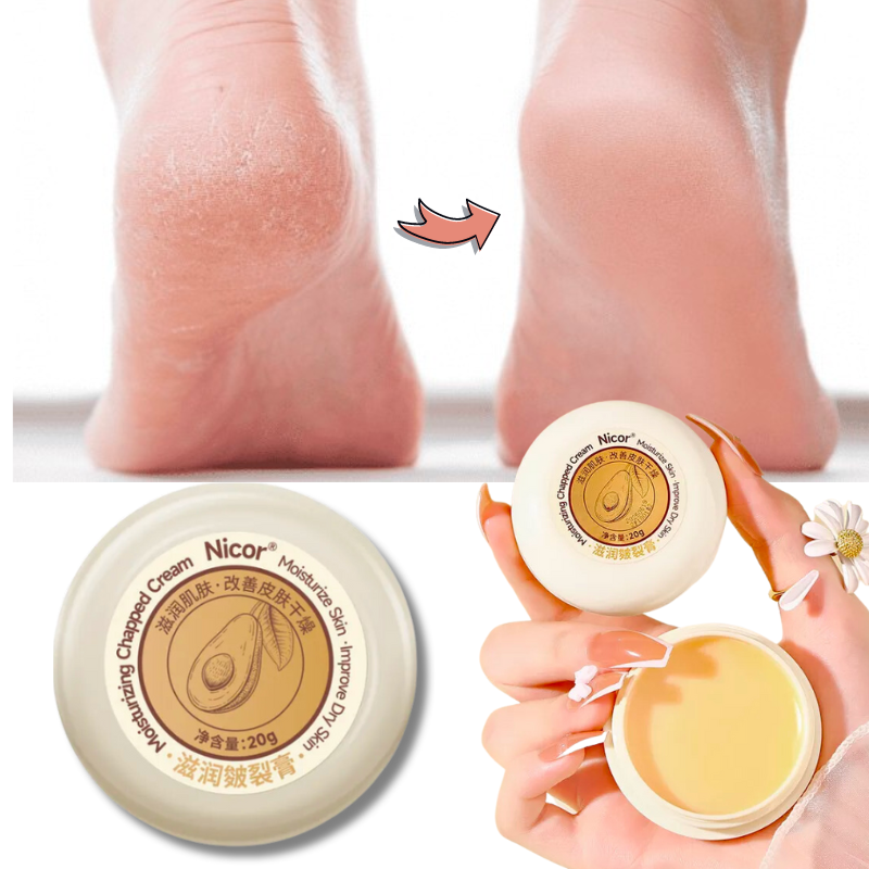 Kem Dưỡng Ẩm Cao Cấp Giảm Khô Nứt Nẻ Chân Tay NICOR Làm Liền Vết Nứt Gót Chân Giảm Đau Nhức Chống Khô Nứt Da Cho Đôi Gót Chân Mịn Màng Và Hồng Hào Nhanh Chóng.