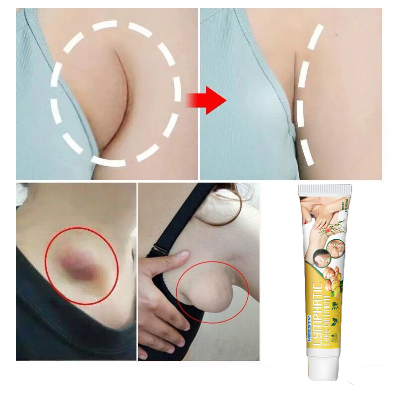Kem bạch huyết Kem loại bỏ hạch bạch huyết Bắp tay Hạch bạch huyết cổ Hạch bạch huyết sau tai Hạch bạch huyết hõm nách Hạch bạch huyết cơ thể Giảm viêm bạch huyết