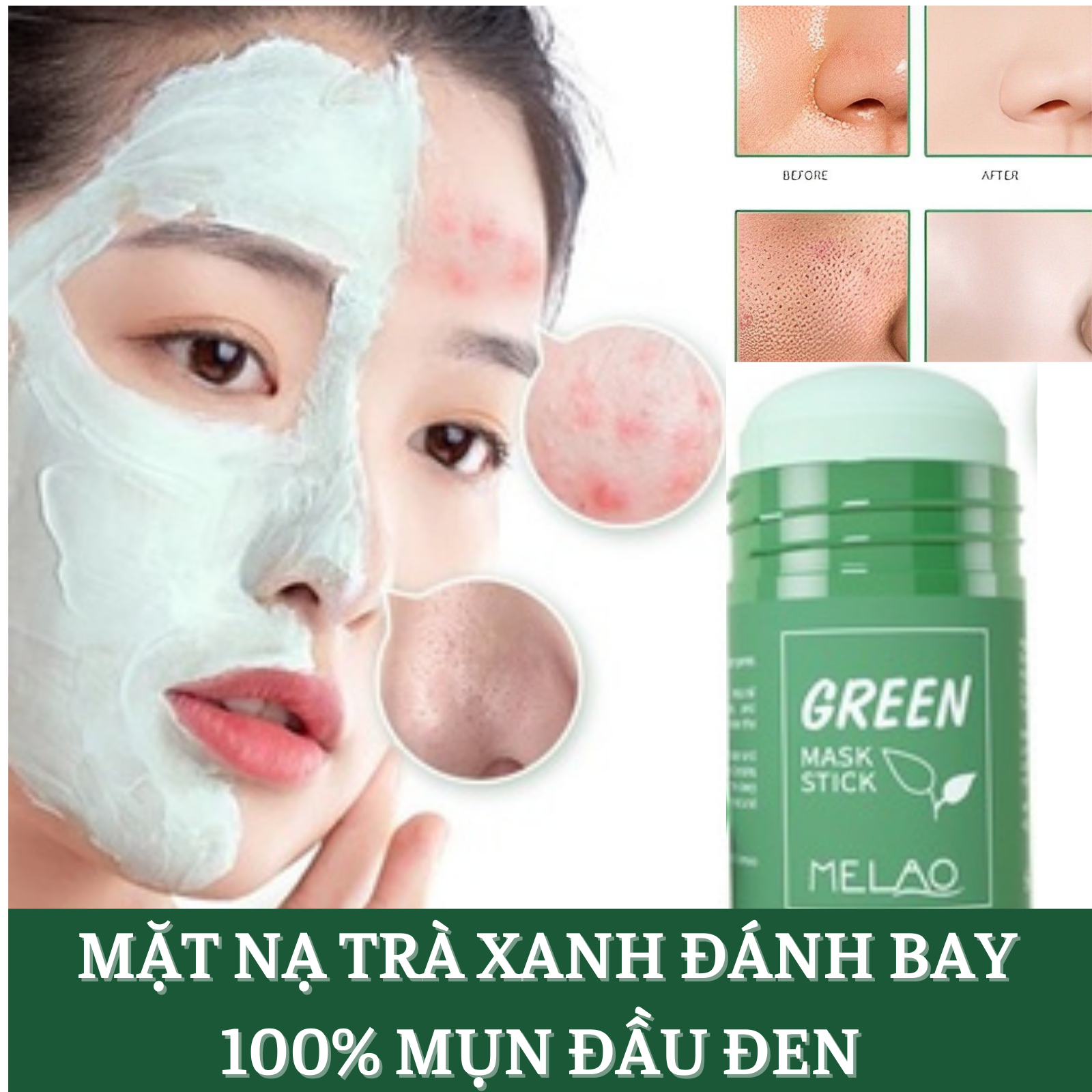 Mặt nạ lăn trà xanh dạng lăn - nạ đất set trắng da- se khít lỗ chân lông