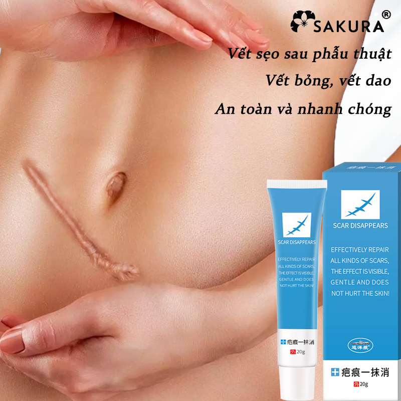 Kem làm mờ sẹo chăm sóc sẹo giảm sẹo mụn Phục hồi sẹo rỗ sẹo thâm Vết bỏng Làm mờ vết rạn da khi mang thai Loại bỏ sẹo mụn xóa vết sẹo cũ 20g