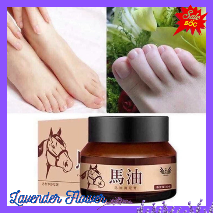 [ HCM ] KEM DẦU GIẢM NỨT GÓT CHÂN