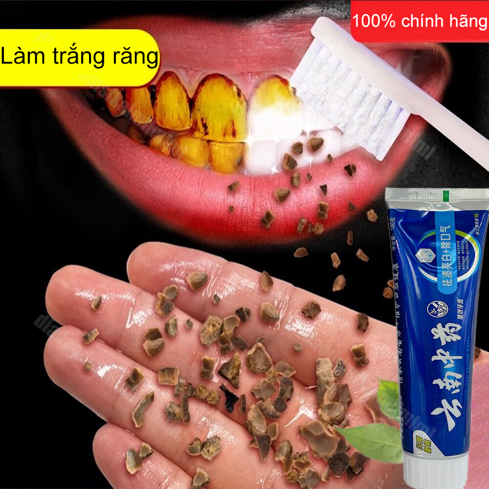 Kem đánh răng làm trắng răng loại bỏ ố vàng răng loại bỏ mảng bám trên răng khử mùi hôi miệng vệ sinh răng miệng cao răng mảng bám