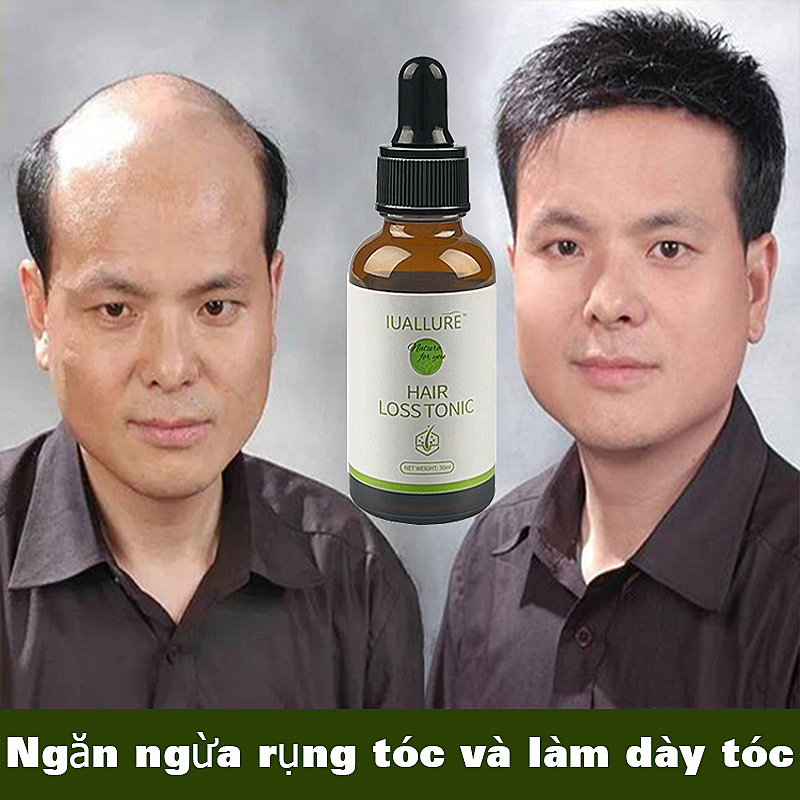Hair loss anti hair loss serum hair growth repair spray fast growth anti