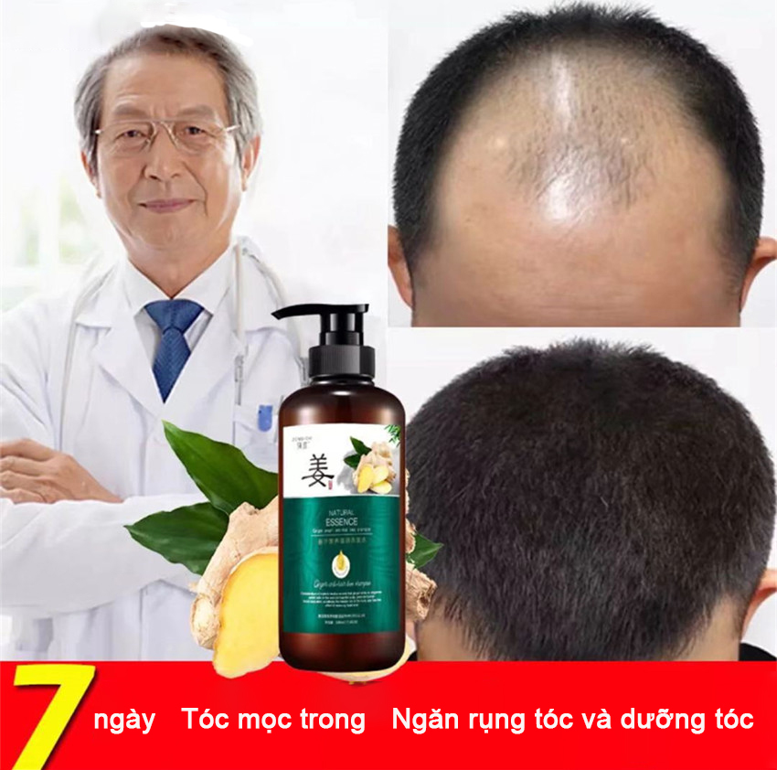 Dầu gội gừng Dầu gội chống rụng tóc Gội đầu mọc tóc Dầu gội đầu làm rậm tóc Ngăn rụng tóc và dưỡng tóc Kích thích mọc tóc tươi mát chống dầu gốc tóc vững chắc và tóc khỏe mạnh