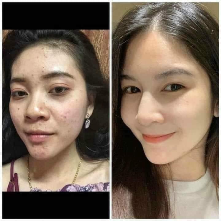 [Mới] Đông Y GT Thảo Mộc Linh tái tạo da mụn, nám, tàn nhang chính hãng có check mã QR