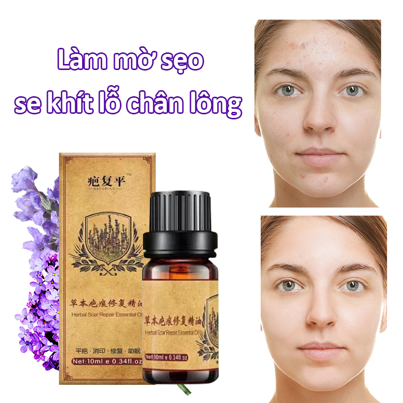Làm mờ sẹo serum sẹo giúp làm mờ vết thâm sẹo trên da se khít lỗ chân lông mờ sẹothâm sẹo lồi sẹo lõm sẹo 10ml