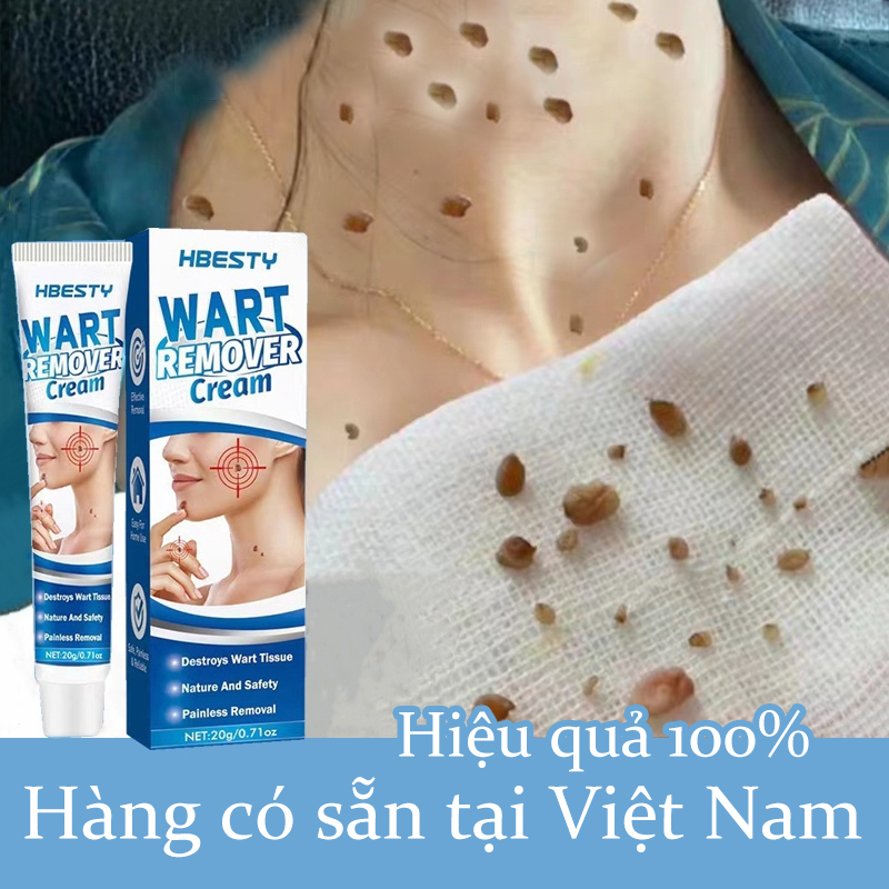 Kem bôi hết mụn cóc,mụn cơm nhanh chóng lọ,kem bôi rụng hết sạch mụn thịt thừa, mụn cóc, mụn nốt duồi