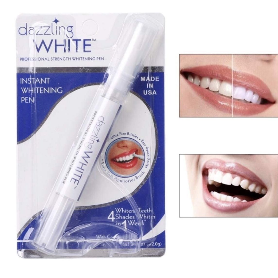 Bút trắng răng dazzling white