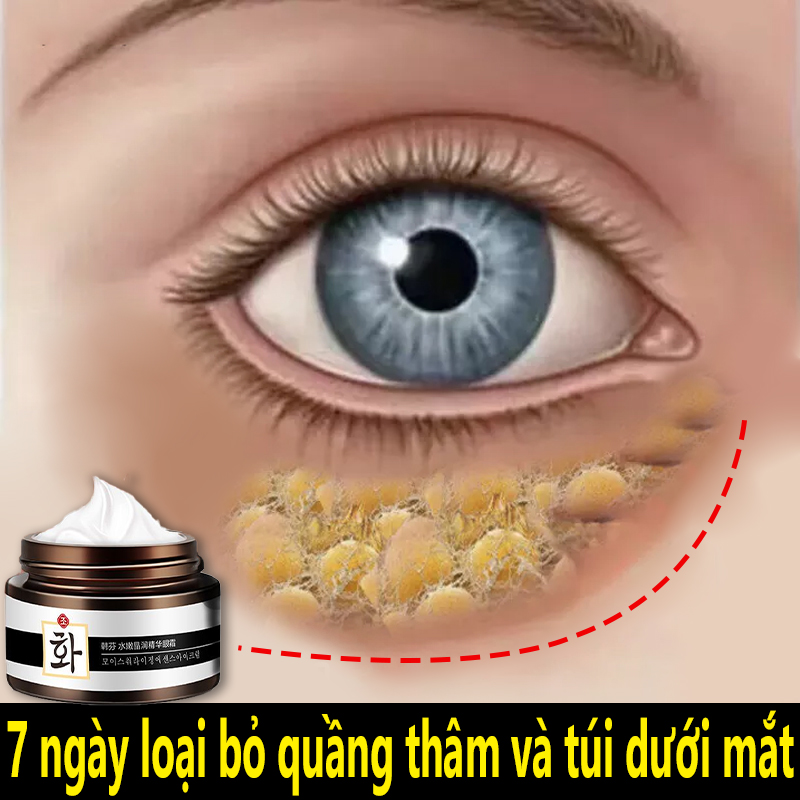 Kem mắt hàn quốc,kem tham mắt,kem mắt,thâm mắt nữ,bọng mắt,thâm quầng mắt,chống lão hóa,Cải thiện nếp nhăn ở mắt