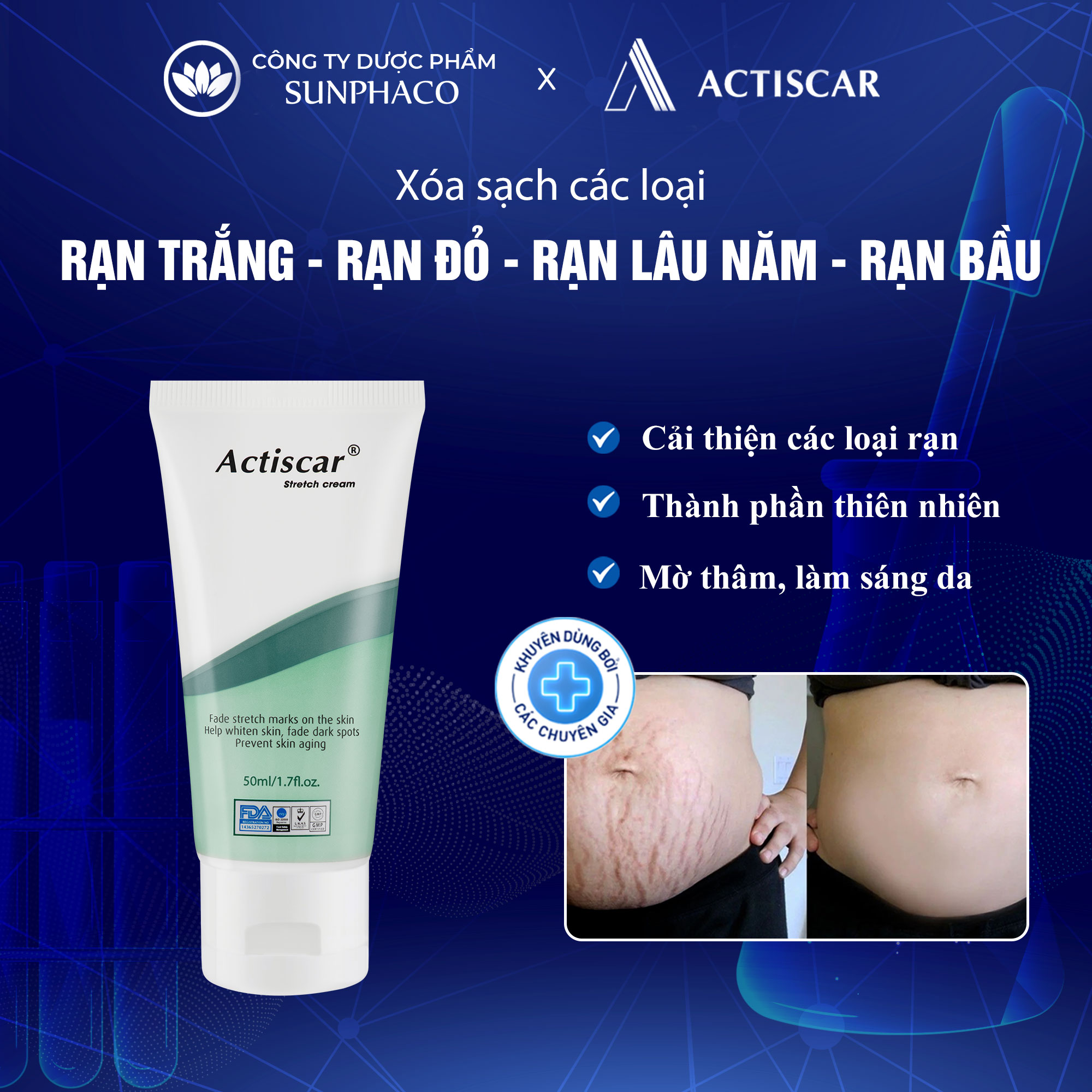 Kem rạn da làm mờ rạn trắng, rạn đỏ actiscar 50ml xóa sạch rạn bà bầu, rạn do tăng cân, dậy thì, rạn lâu năm