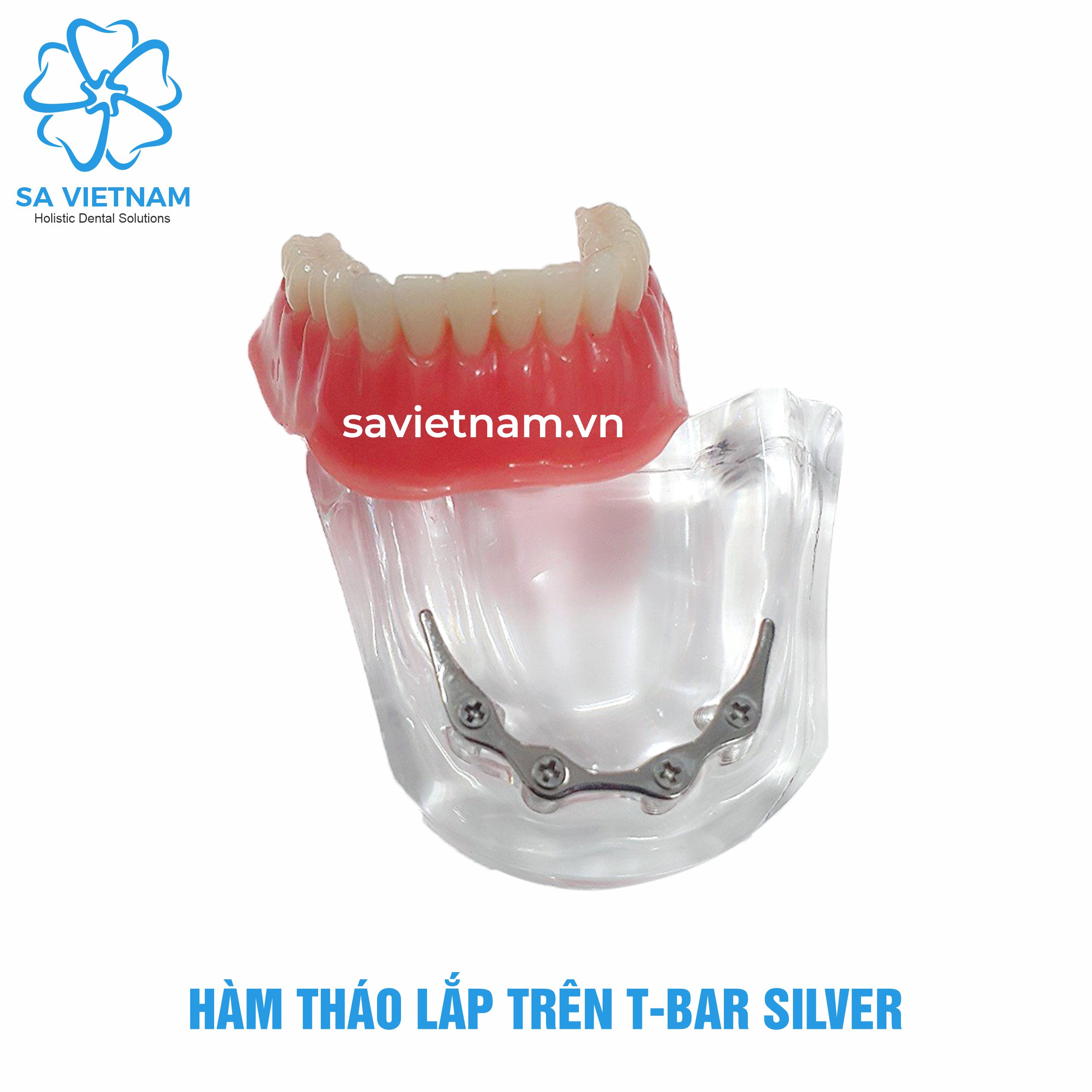 𝐇𝐚̀𝐦 𝐭𝐡𝐚́𝐨 𝐥𝐚̆́𝐩 𝐭𝐫𝐞̂𝐧 𝐓-𝐁𝐚𝐫 𝐒𝐢𝐥𝐯𝐞𝐫 - Hàm tư vấn nha khoa, mẫu tư vấn nha khoa