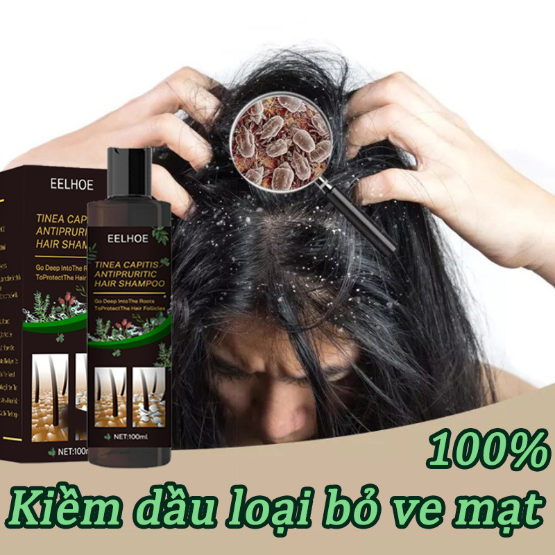 Dầu gội sạch mảng gàu trắng và hết nấm da đầu 100g - dầu gội tri gàu, nấm da đầu, vẫy nến hết ngứa, giảm rụng tóc, kích thích mọc tóc, giảm bết và ngừa nhờn