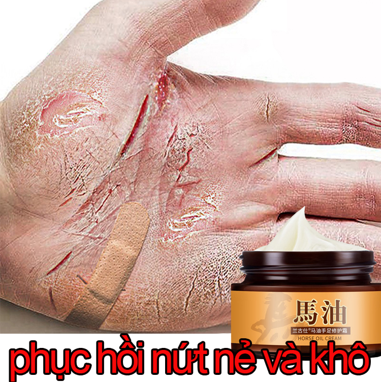 kem phục hồi da chân tay mỡ ngựa Kem bôi tay [30g]Phục hồi da nứt nẻ Cải thiện nếp nhăn Dưỡng ẩm sâu