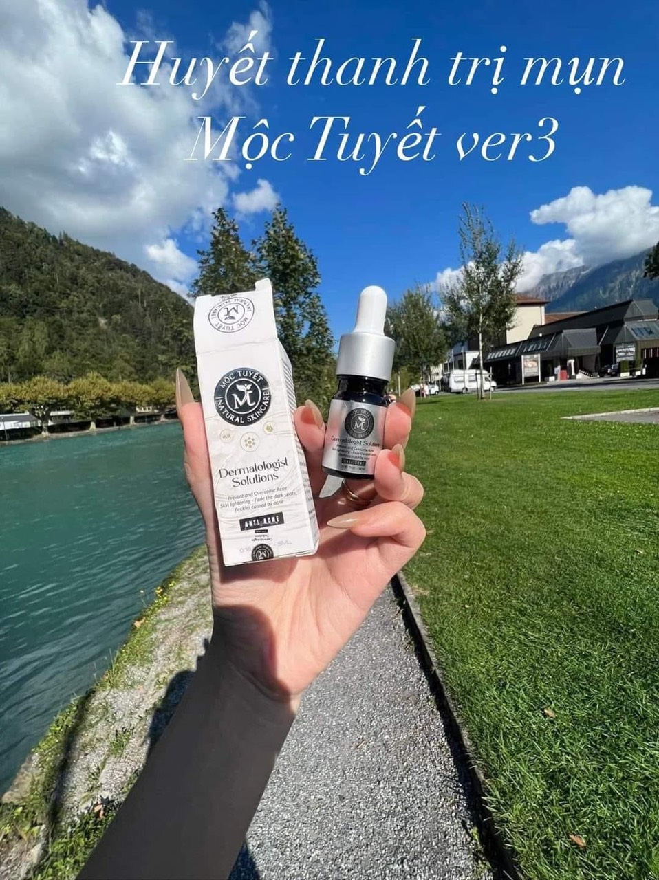 [MẪU MỚI] Huyết Thanh Ngừa Mụn Chính Hãng [DATE MỚI]..