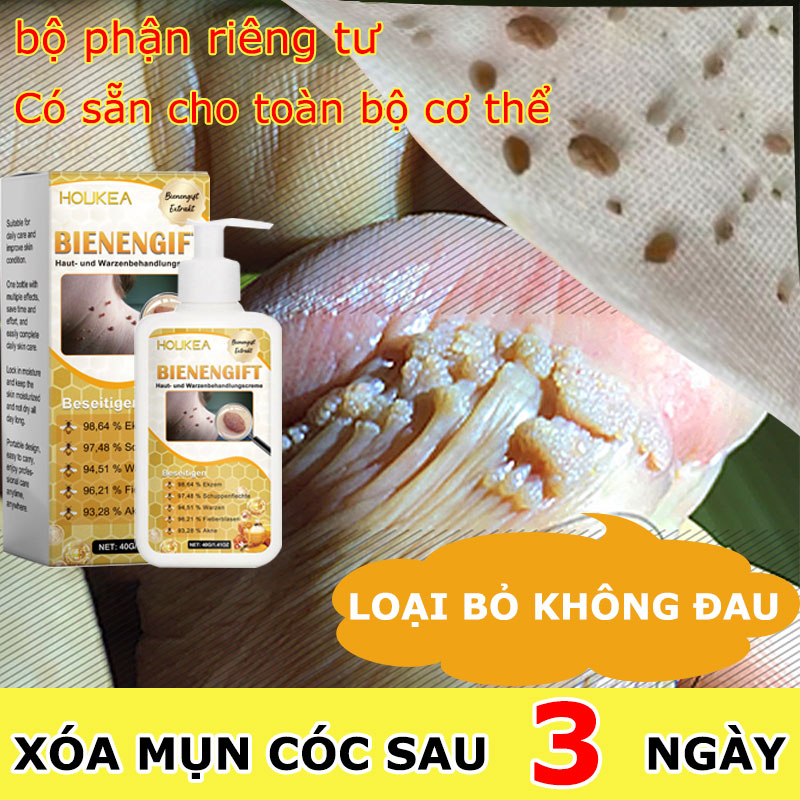 kem mụn cóc giúp bạn xóa đi khuyết điểm toàn thân hiệu quả nhanh chóng trong 7 ngày Kem Bôi Xóa Mụn Thịt, Thịt Thừa, Mụn Cóc, Nốt Ruồi Không Đau, Ngứa, Không Tổn Thương Da  40g