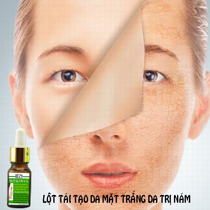 Peel Trắng Bong Da Xóa Nám Sạm