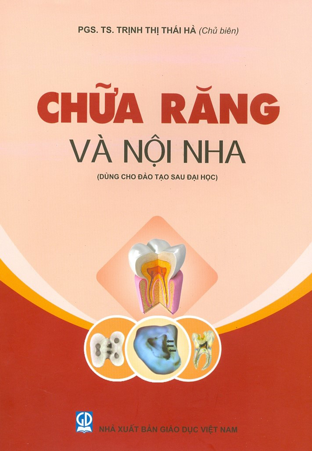 Chữa Răng Và Nội Nha (Dùng Cho Đào Tạo Sau Đại Học)