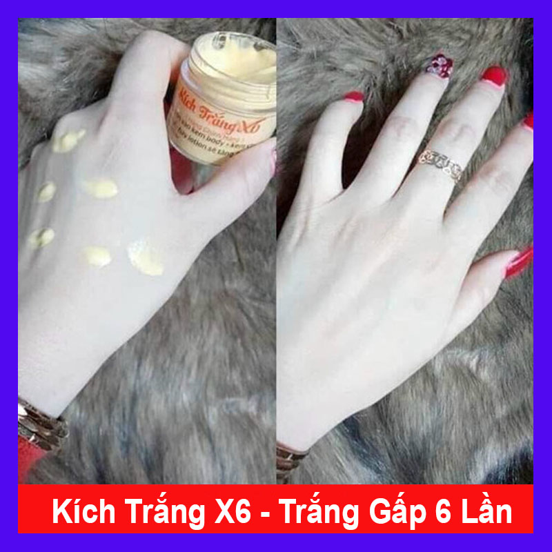 Kem body kích trắng x6 trắng gấp 6 lần