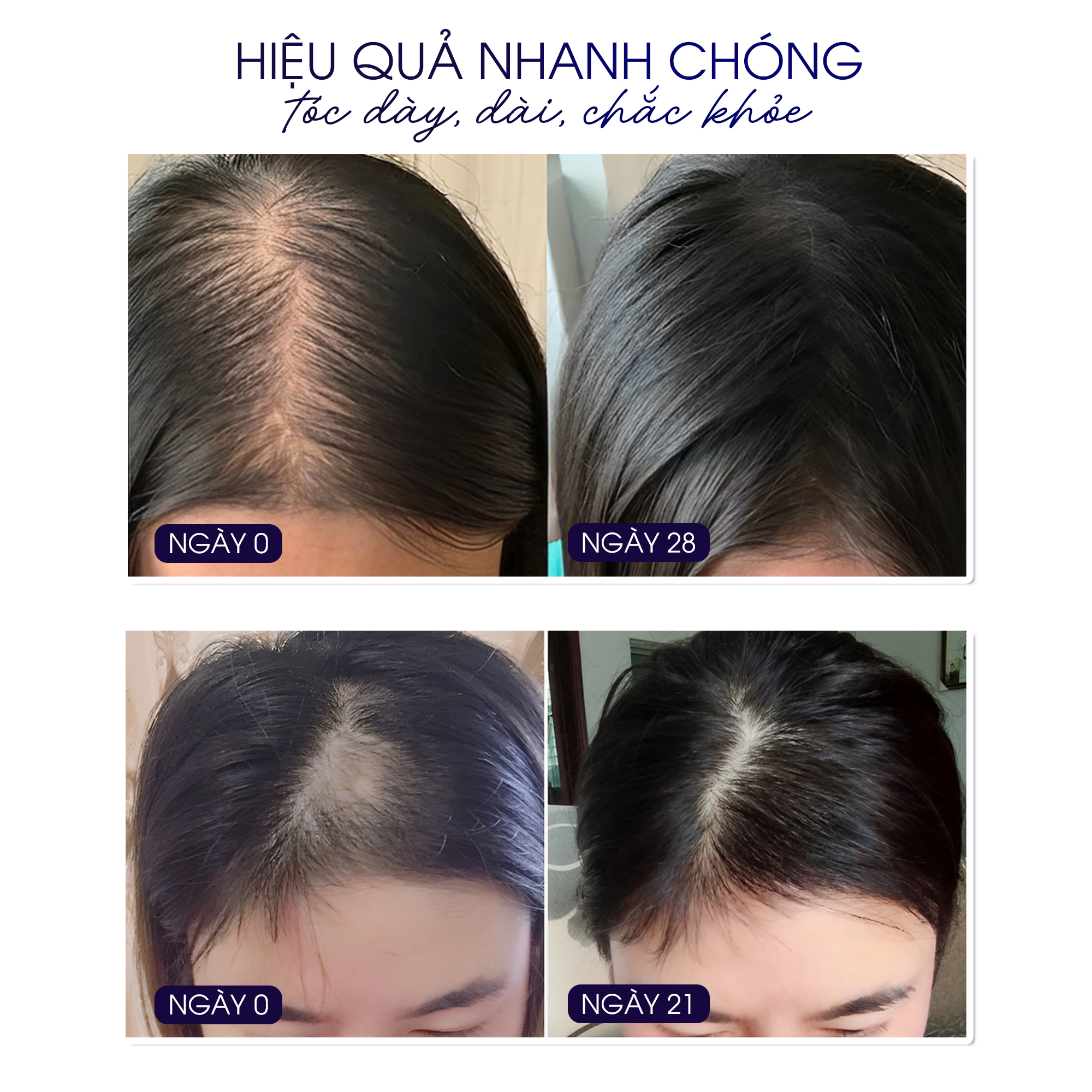 FEG Hair Growth Spray - Xịt Dưỡng Kích Thích Mọc Tóc FEG Giúp Tóc Dày và Dài Sau 14 Ngày