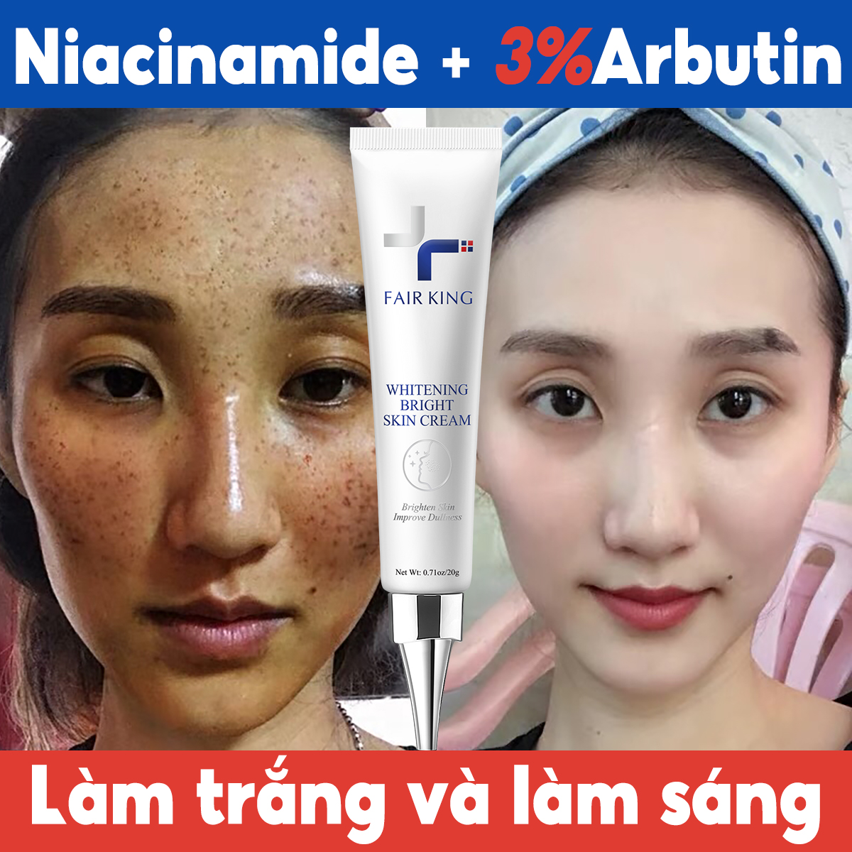 FAIR KING Kem làm mờ vết thâm làm trắng da Serum xóa vết thâm làm sáng da giảm đốm tàn nhang Kem dưỡng da mặt 20g