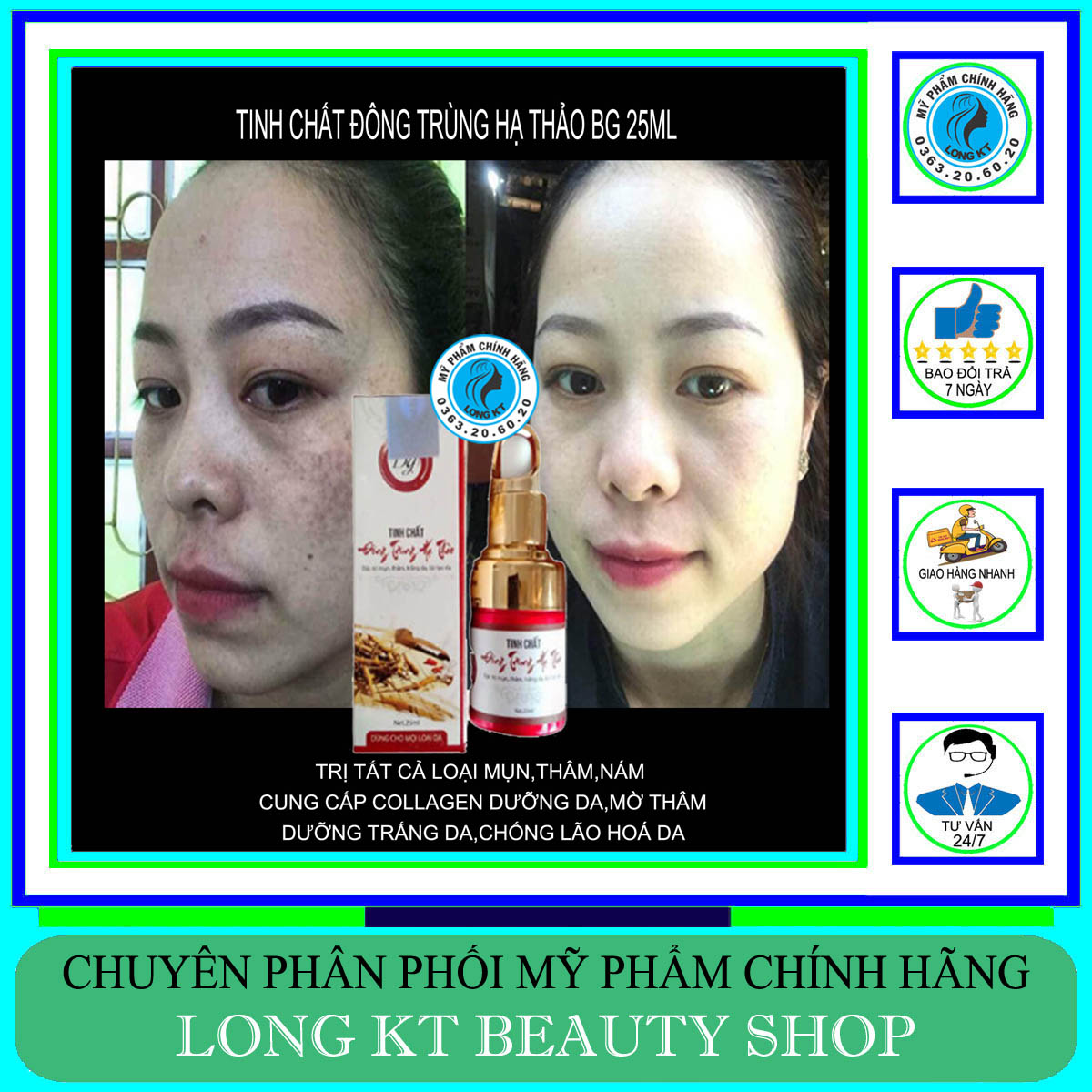 Chính Hãng - Bán Chạy Tinh Chất Đông Trùng Hạ Thảo BG 25ml - Tinh Chất Đông Trùng Hạ Thảo BG Đặc Trừ Mụn, Thâm, Nám, Tàn Nhang, Trắng Da