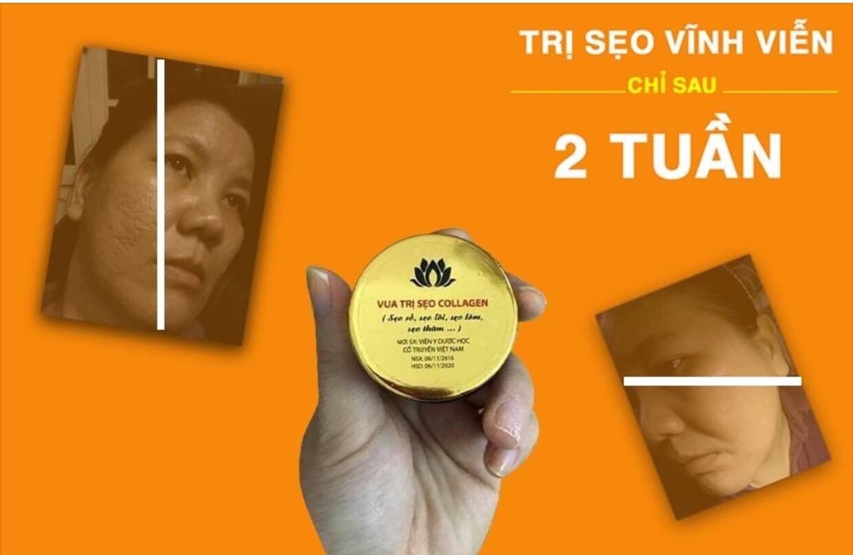 Trị Sẹo Collagen