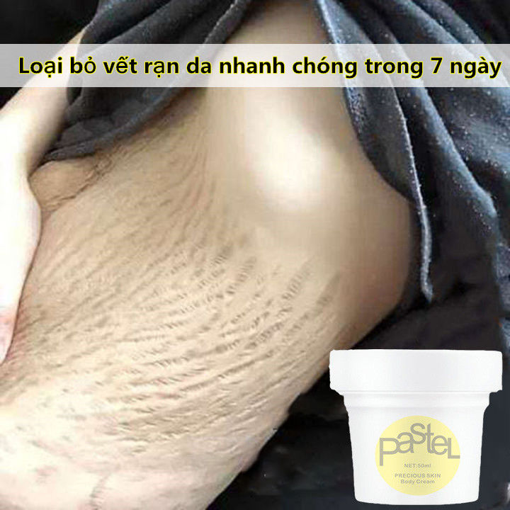 [Xóa vết rạn da trong 7 ngày] Kem chống rạn da 50ml, kem làm trắng và phục hồi nhanh chóng và nhẹ nhàng làm mờ vết rạn da sau sinh, xóa vết rạn da do béo phì, xóa mờ vết thâm và làm sáng da