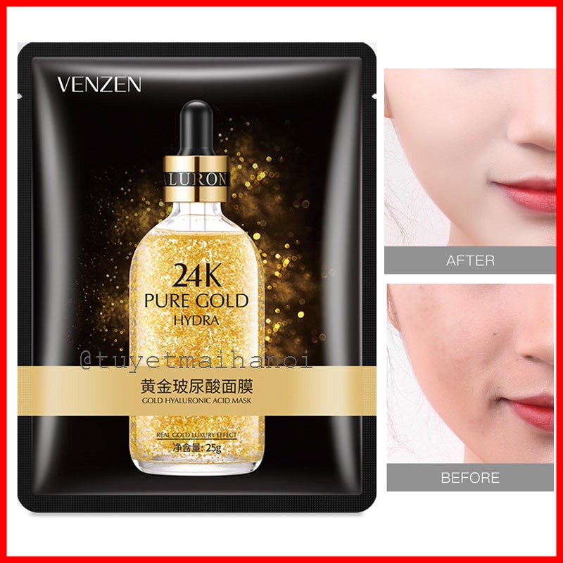 Mặt Nạ Tinh Chất Vàng 24K Pure Gold Venzen