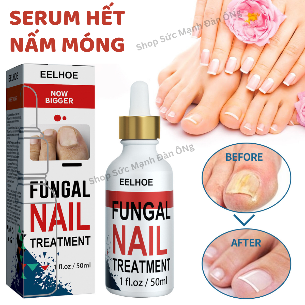 Serum phục hồi nấm móng, móng hư thối tổn thương và biến dạng giúp móng chắc khỏe trắng hồng