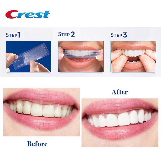 Miếng dán trắng răng Crest 3D - Mỹ ( Lẻ 1 gói)