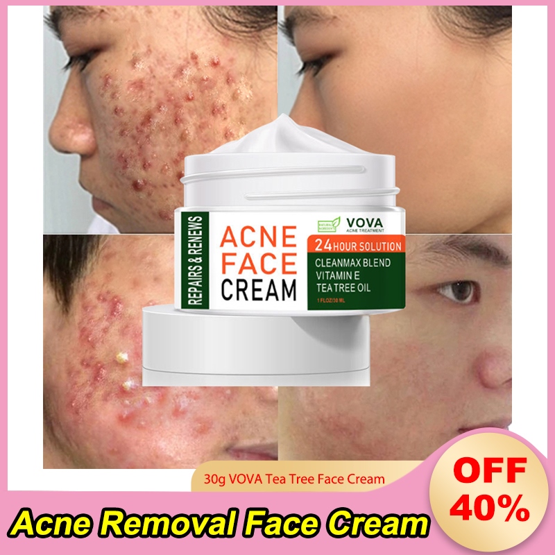 【CW】 VOVA Tree Acne Removal Face Anti-Acne Repair Fade Spots Pimple Shrink Pores Gel Whitening Oil Control