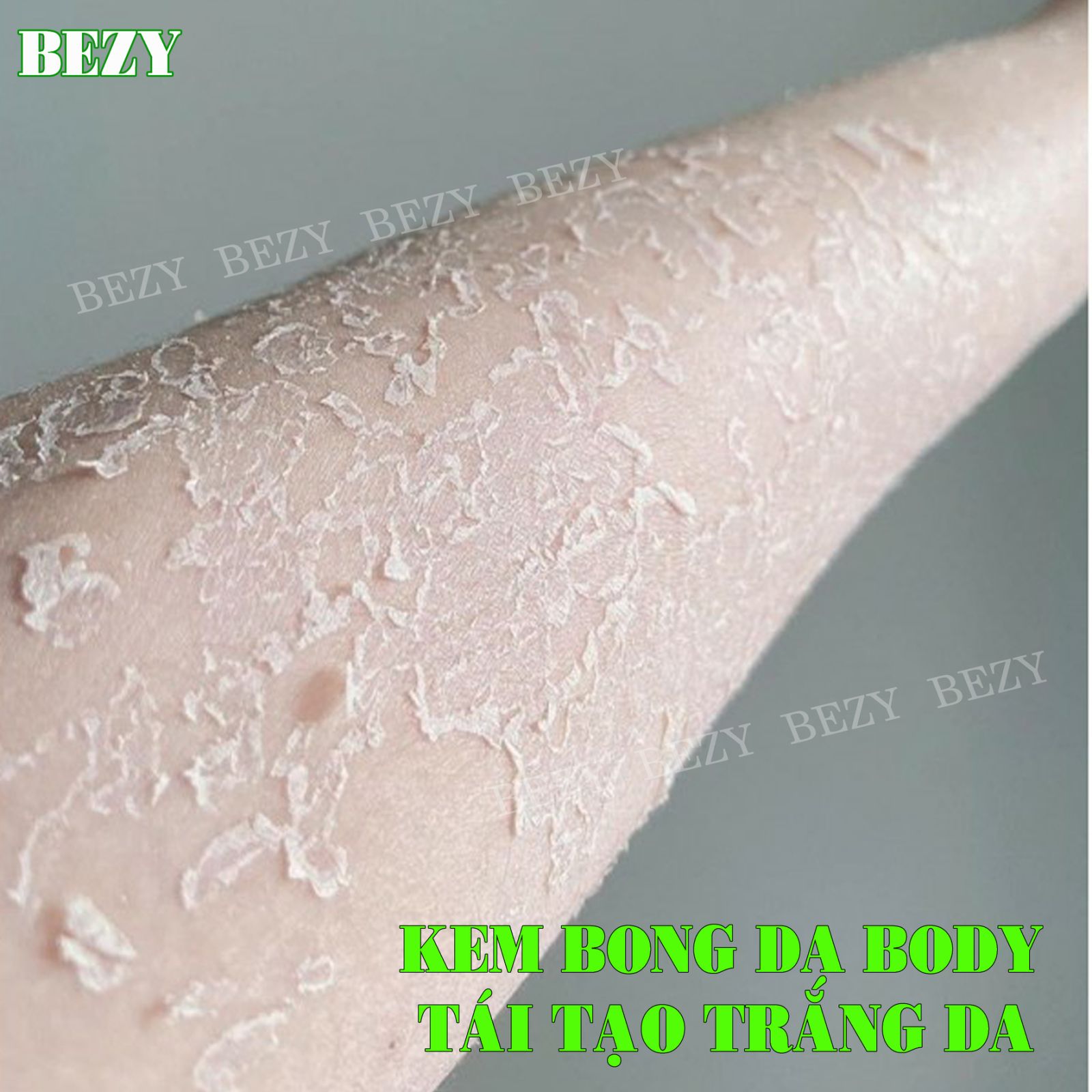 Kem bong da body siêu trắng tái tạo nhanh cao cấp