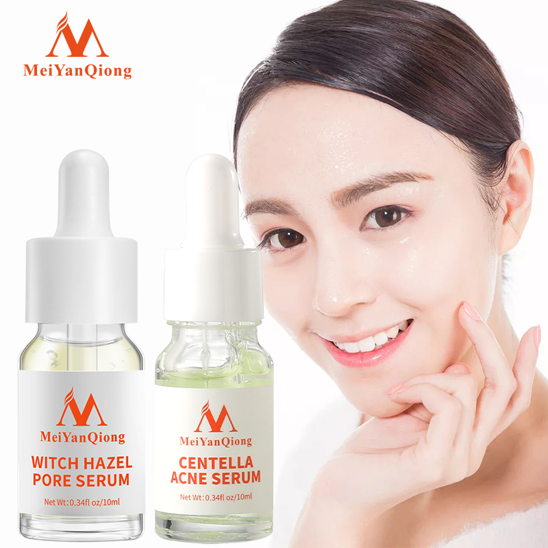 MeiYanQiong Tinh chất cây phỉ giúp thu nhỏ lỗ chân lông