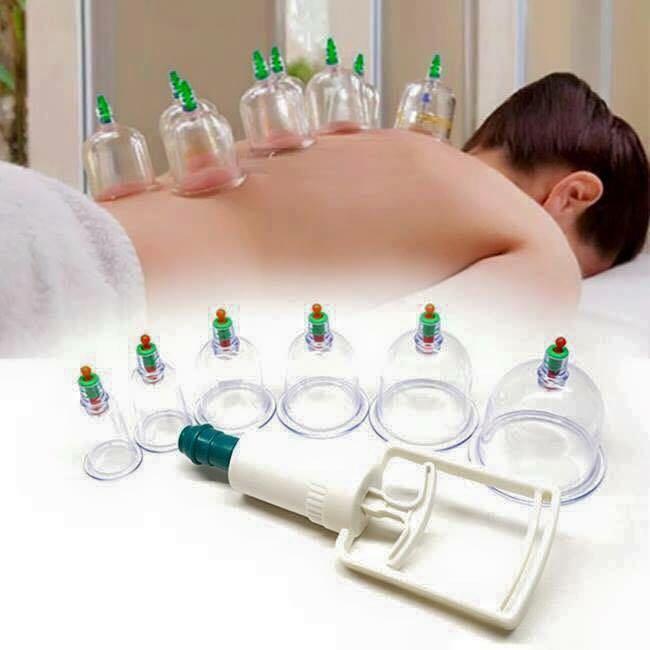 Bộ giác hơi không dùng lửa 12 ống [HÀNG CAO CẤP] Y TẾ ĐỨC ANH