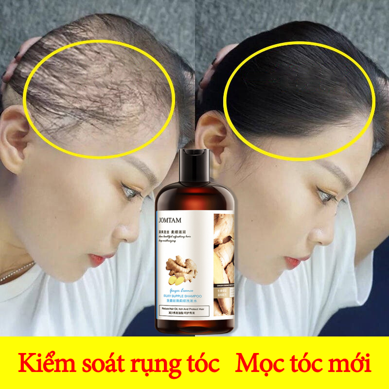 Dầu Gội Thảo Dược dầu gội chống rụng tóc Phục Hồi Tóc Hư Giảm Rụng Tóc Phục Hồi Khô Sơ Hư Tổn Dầu gội dược liệu các loại cho tóc thường, tóc hư tổn, tóc gàu, tóc bết