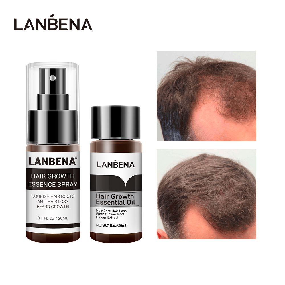 LANBENA Dầu tinh chất mọc tóc + Xịt tinh chất mọc tóc  Nhanh Quyền lực Ngăn ngừa Hói đầu đầu chống rụng tóc  nuôi dưỡng chân tóc 2 CÁI