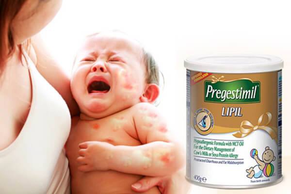 Sữa Pregestimil cho trẻ dị ứng đạm sữa bò 400g cho bé 0 - 12 tháng