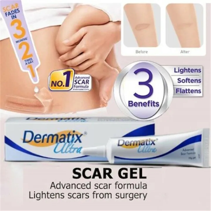 Kem sẹo Kem trị rạn da phục hồi sau sinh.làm mờ vết rạn,cải thiện sẹo lâu năm，giúp da mịn màng,kemphục hồi săn chắc，căng da,xóa sẹo,mờ sẹo,ngừa sẹo， kem làm trắng da ,tuýp 15g