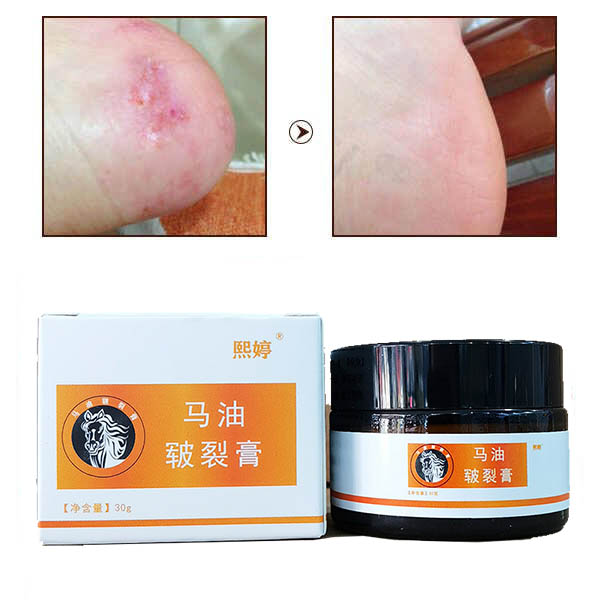 Kem mỡ ngựa bôi chân tay kem chăm sóc vùng chân tay chống nứt nẻ gót chân kem làm mềm chống nứt nẻ dưỡng ẩm chuyên sâu chăm sóc da khô nứt gót chân khô nẻ bong tróc do đi guốc cao