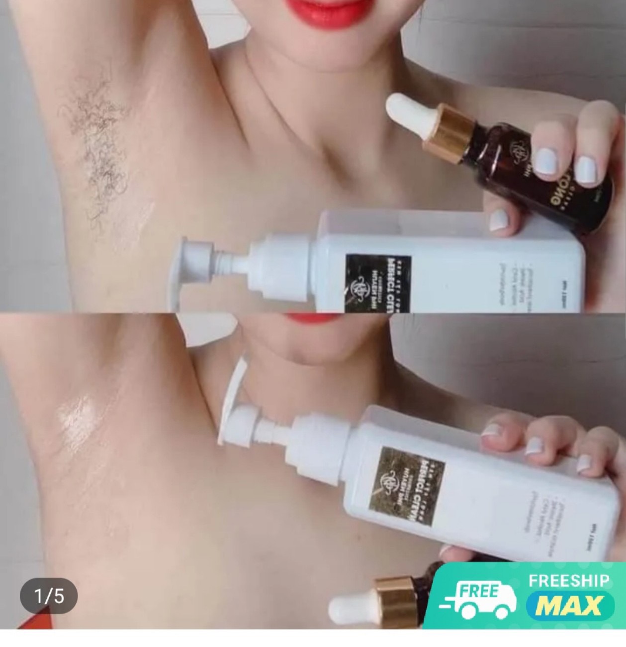 Bộ tẩy lông_ Gồm 1 kem tẩy lông+ 1 serum ức chế lông mọc laị