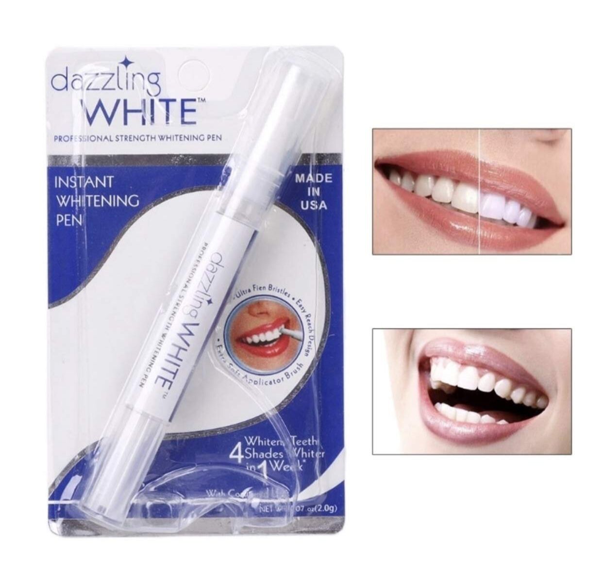 Bút trắng răng dazzling white