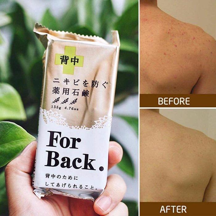 Xà phòng trị mụn lưng For Back Medicated Soap của Nhật