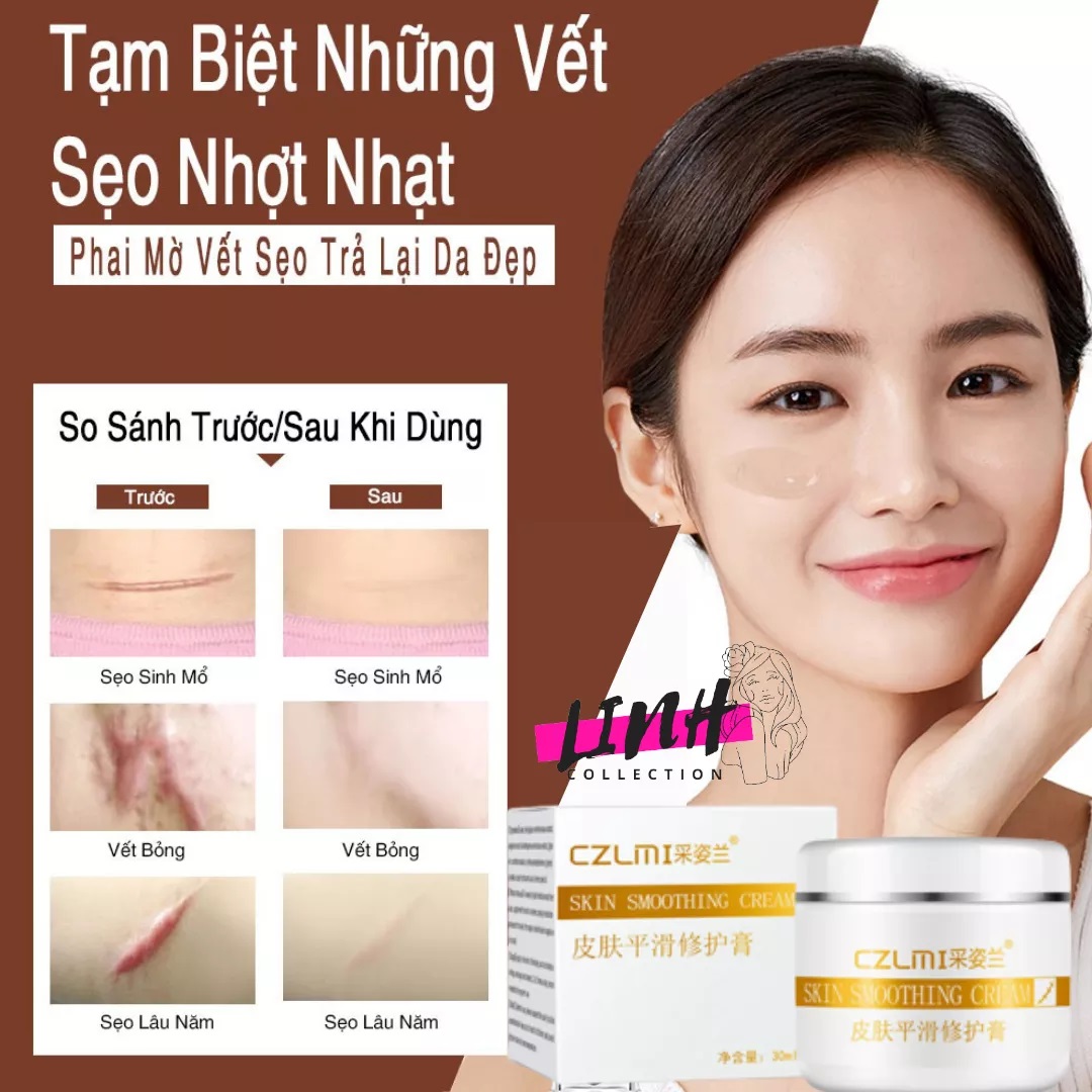 Kem mờ sạch các loại sẹo caizila 30g loại bỏ 100% sẹo làm hết rạn da sáng da dánh bay mọi vết thâm sẹo thâm bỏng thâm mụn
